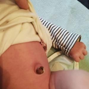 cordring-newborn-300x300-1.jpeg